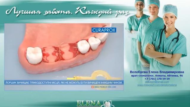 Межзубный ёршик... А вы знаете, как правильно им пользоваться? смотреть онлайн