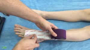 ✅ Боль в стопе. Как с помощью тейпирования помочь пациенту?