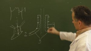 Схема желудочного свища по Топроверу