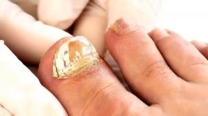 Маз барои гирибок