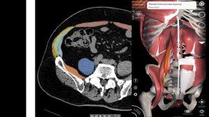 Анатомия паховой зоны на КТ и моделировании