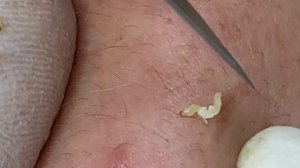 Satisfying Relaxation Skin Video With Dr. Thuy Quynh Giao Spa #03 31/05/2021