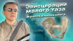 Онкологические операции на органах малого таза. Эвисцерации