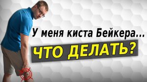 Киста Бейкера что делать? Упражнения