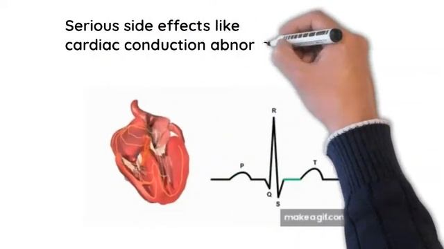 All you need to know about Lacosamide ( a new antiepleptic drug) смотреть онлайн