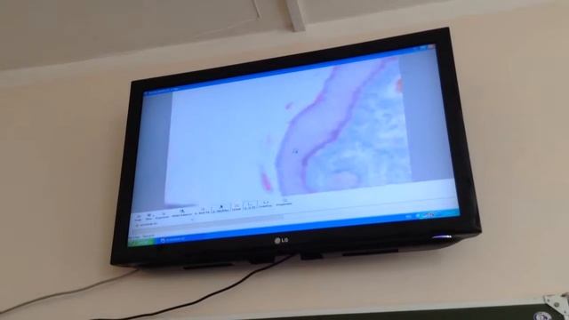 Гистология. Губа на препарате развития зуба смотреть онлайн