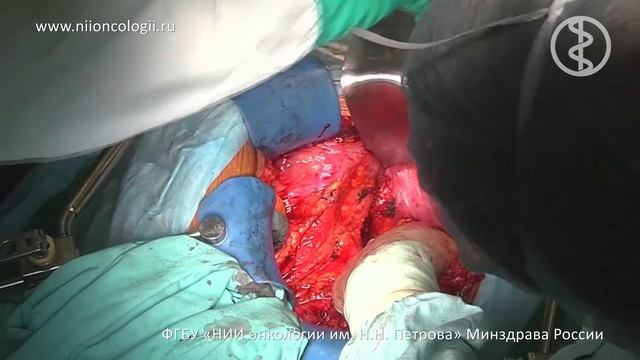 Открытая ТМЕ Царьков ПВ