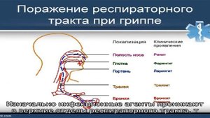 Как отличить трахеит от бронхита