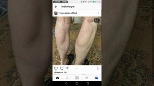 У Кирила Терешина Гниют Руки Руки Базуки отваливаются, ляжет скоро в госпиталь
