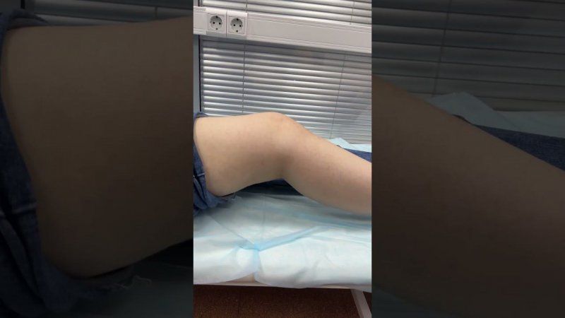 Как не надо Лечить Разрыв Передней Крестообразной Связки
