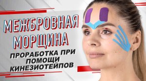 ▶️ МЕЖБРОВНАЯ МОРЩИНА / МЕТОДИКА ПРОРАБОТКИ ПРИ ПОМОЩИ КИНЕЗИОТЕЙПИРОВАНИЯ | Валентин Гайт|BBALANCE