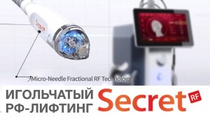 Игольчатый РФ-лифтинг Secret RF. Особенности процедуры