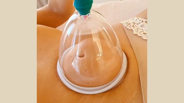 Вакуумный массаж живота, ягодиц, груди, спины