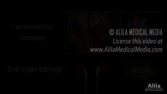 Hypertension - High Blood Pressure, Animation смотреть онлайн