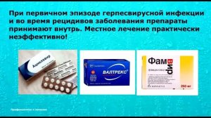 Герпес. Лечение и профилактика