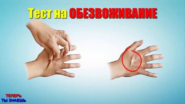 УЩИПНИТЕ Себя За РУКУ и Отпустите! Простой ТЕСТ На ОБЕЗВОЖИВАНИЕ Организма!