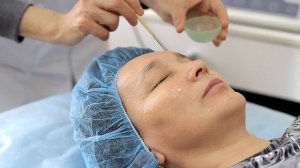 Химические пилинги