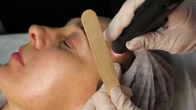 Плазменное омоложение кожи лица смотреть онлайн