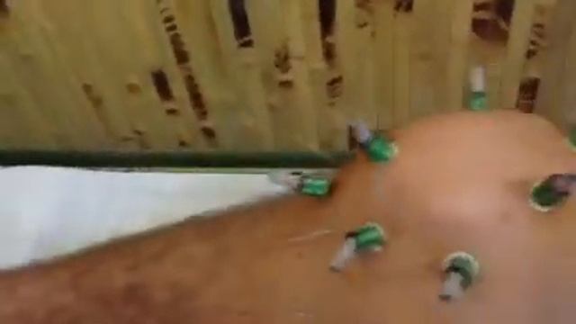 Ревматроідний артрит лікування в Трускавці Клініка голкотерапіі Доктора Кіма смотреть онлайн