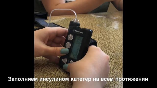 Замена инфузионного набора инсулиновой помпы. #помпа #сд1 #сахарныйдиабет #вдкбвгму #диабет #чубаро смотреть онлайн