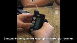 Замена инфузионного набора инсулиновой помпы. #помпа #сд1 #сахарныйдиабет #вдкбвгму #диабет #чубаро