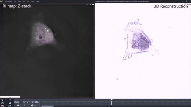 Apoptosis: Melanoma cells (Me 260.LN) blebbing