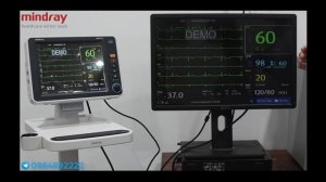 ECG interpretation method on Mindray uMEC10 Patient Monitor