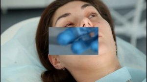 Удаление невуса на лице