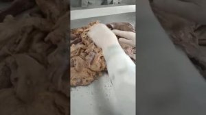 Брюшная полость .Анатомия