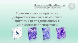 "Цитологический скрининг рака шейки матки"