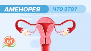 ? Аменорея / Почему исчезли менструации?