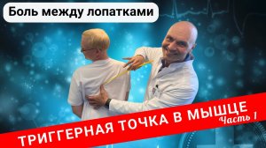 БОЛЬ МЕЖДУ ЛОПАТКАМИ. Триггерные точки в мышце (Часть 1)