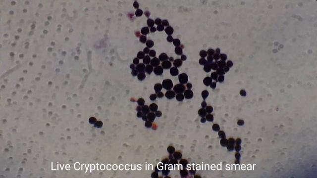 Live and dead Cryptococcus under the Microscope смотреть онлайн