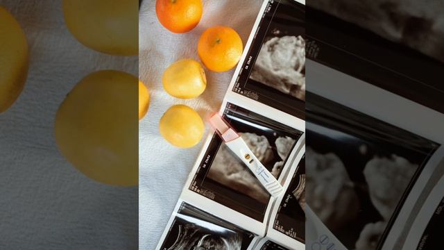 Тест на Беременность | КАК РАБОТАЕТ ЭКСПРЕСС-ТЕСТ НА БЕРЕМЕННОСТЬ? | 2 полоски |Беременность и роды