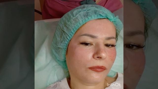 БИОРЕВИТАЛИЗАЦИЯ Подробный ОБЗОР ПРОЦЕДУРЫ //МОИ ВЫВОДЫ И ОЩУЩЕНИЯ.  РЕКОМЕНДАЦИИ С ЛИЧНОГО ОПЫТА.