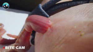 Bitten by Bloodworms!