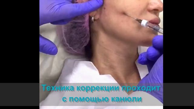 Создаем четкий овал лица, формируем угол молодости