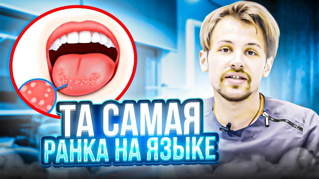 Повреждение языка. Как лечить?