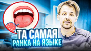 Повреждение языка. Как лечить?