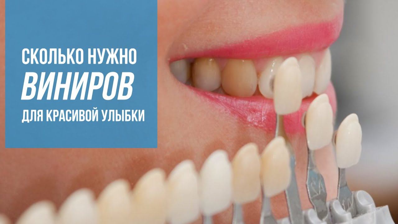 Сколько виниров нужно для красивой улыбки? Что такое зона улыбки? | InSmile | Глеб Пекли