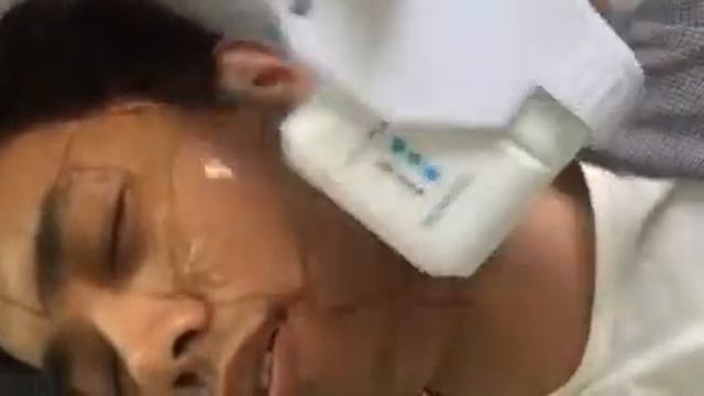 HIFU video смотреть онлайн