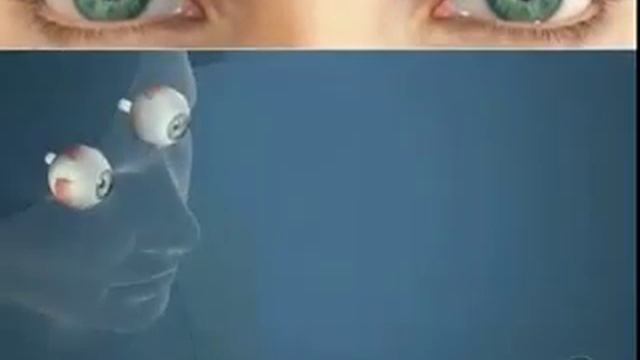 Симптомы косоглазия