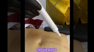 ОБУЧЕНИЕ, ХОЛОДНАЯ ПЛАЗМА