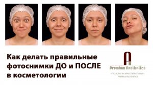 Как делать правильные фотоснимки ДО и ПОСЛЕ в косметологии