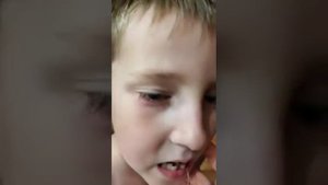 как вырвать молочный зуб, с помощью нитки и пистолета