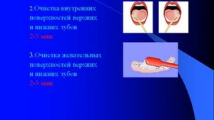 Гигиена полости рта.AVI