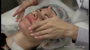 Лицо после пилинга ТСА Джеснер, закрываем процедуру