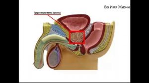 Как вылечить простатит