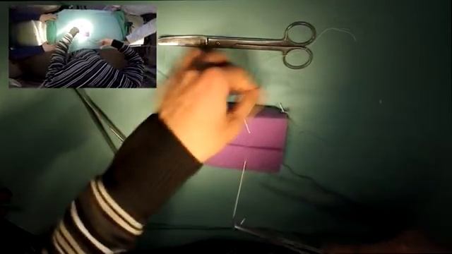 Наложение узлового шва - способ земских хирургов смотреть онлайн