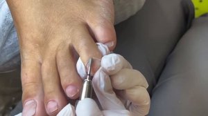 Срез кутикулы в аппаратной технике